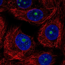 TRIM52 Antibody, Novus Biologicals 25 &mu;L, Unlabeled:Antibodies, Polyclonal